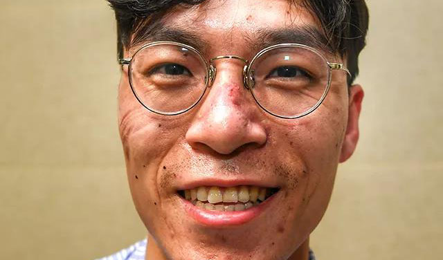這些刻在我們臉上的印痕，會成為永恒的記憶！
